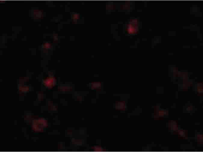 AIM Antibody in Immunocytochemistry (ICC/IF)