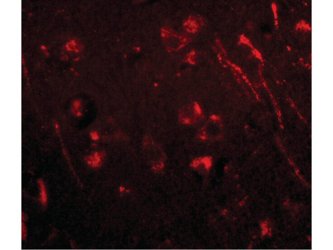 AIPL1 Antibody in Immunocytochemistry (ICC/IF)