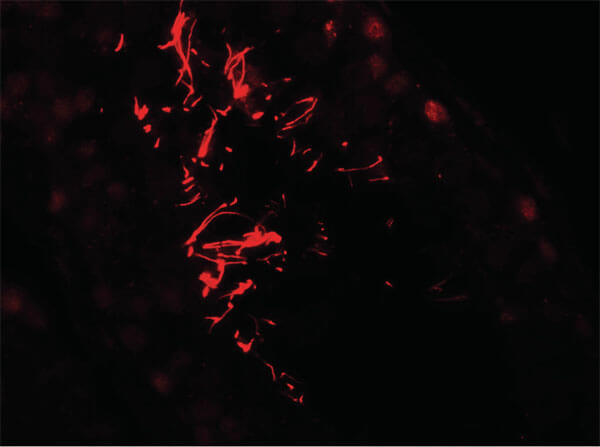 AKAP4 Antibody in Immunocytochemistry (ICC/IF)
