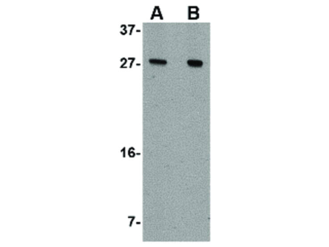 AKIRIN1 Antibody in Western Blot (WB)