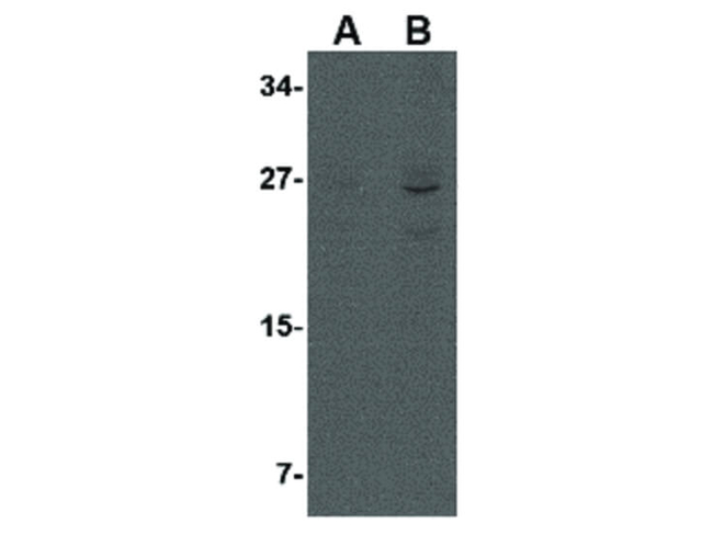 AKIRIN1 Antibody in Western Blot (WB)