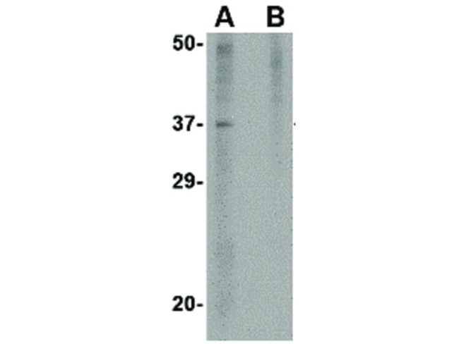 AKIRIN2 Antibody in Western Blot (WB)