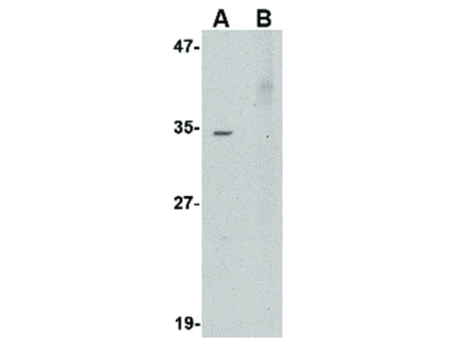AKIRIN2 Antibody in Western Blot (WB)