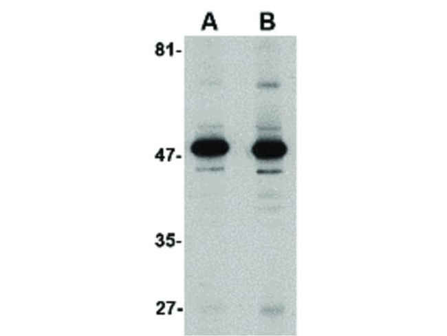 ALDH3A1 Antibody in Western Blot (WB)