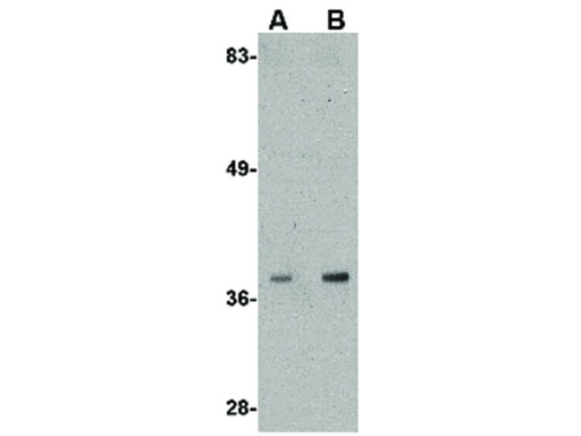 ALDH3A2 Antibody in Western Blot (WB)