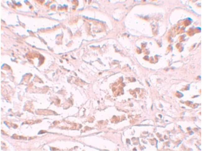 ALKBH2 Antibody in Immunohistochemistry (Paraffin) (IHC (P))