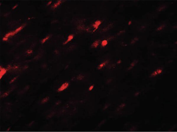ANGPTL3 Antibody in Immunocytochemistry (ICC/IF)