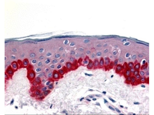 APAF1 Antibody in Immunohistochemistry (Paraffin) (IHC (P))
