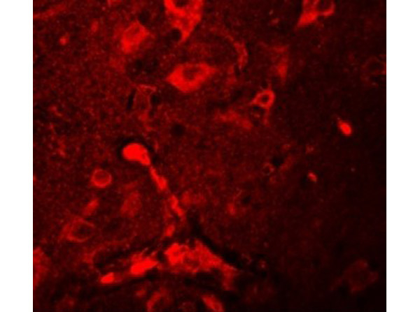 APBA2 Antibody in Immunocytochemistry (ICC/IF)