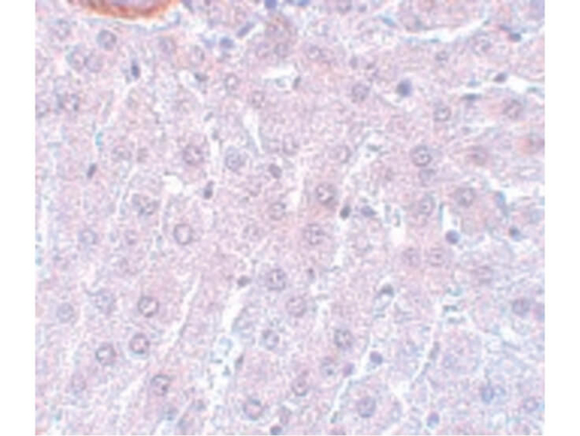 APC3 Antibody in Immunohistochemistry (Paraffin) (IHC (P))