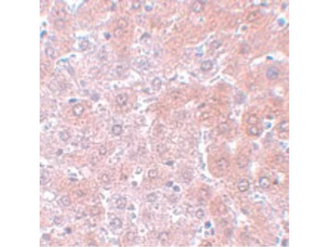 APC4 Antibody in Immunohistochemistry (Paraffin) (IHC (P))