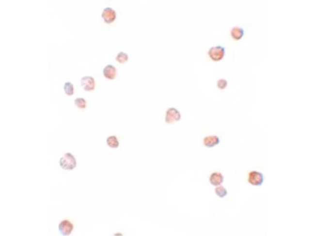 APC8 Antibody in Immunocytochemistry (ICC/IF)