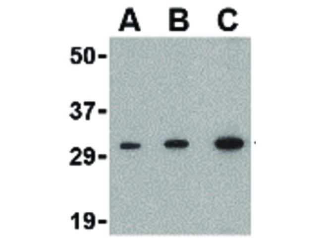 APH1 Antibody in Western Blot (WB)