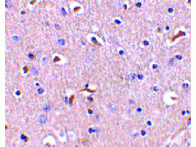 APH1 Antibody in Immunohistochemistry (Paraffin) (IHC (P))