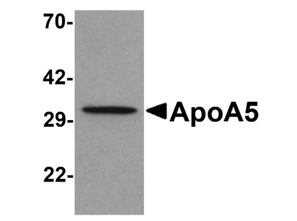 Apolipoprotein A-V Antibody in Western Blot (WB)