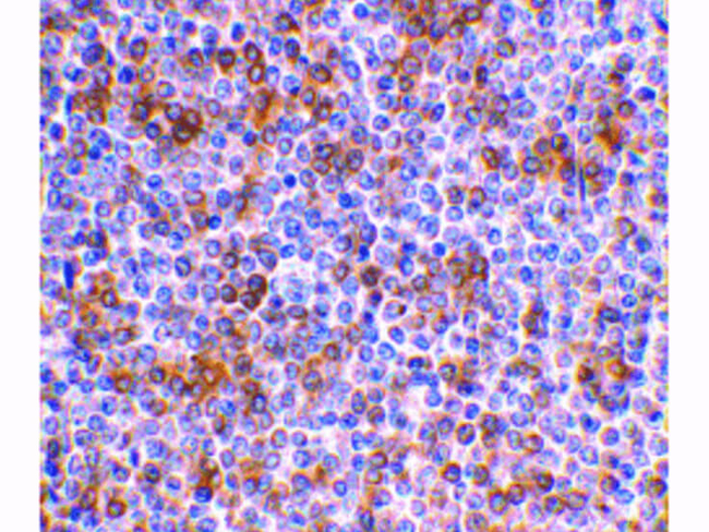 APOBEC3G Antibody in Immunohistochemistry (Paraffin) (IHC (P))