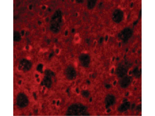 APP Antibody in Immunocytochemistry (ICC/IF)