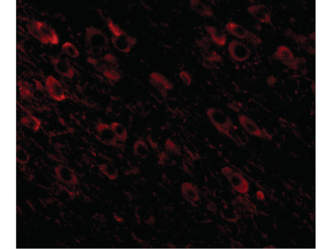 APP Antibody in Immunocytochemistry (ICC/IF)