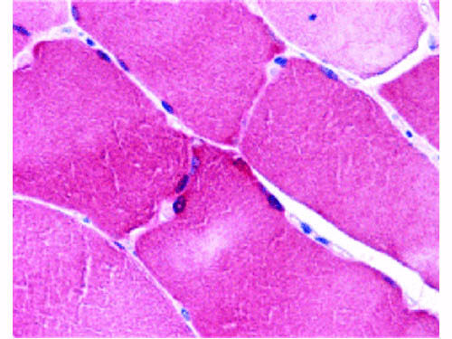 ARC Antibody in Immunohistochemistry (Paraffin) (IHC (P))