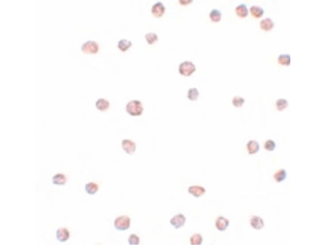 ARHGAP18 Antibody in Immunocytochemistry (ICC/IF)