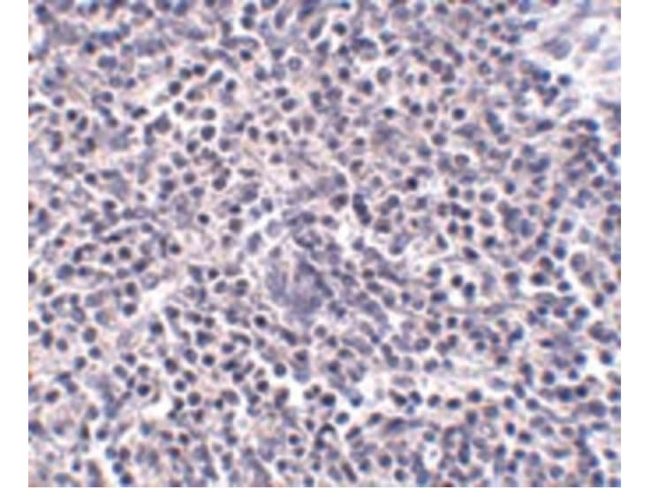 ARL15 Antibody in Immunohistochemistry (Paraffin) (IHC (P))