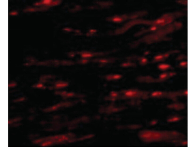 ASAH1 Antibody in Immunocytochemistry (ICC/IF)