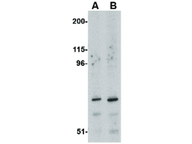 ASAH2 Antibody in Western Blot (WB)