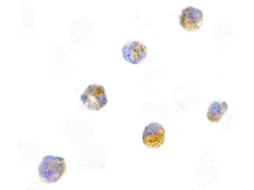 ASC Antibody in Immunocytochemistry (ICC/IF)