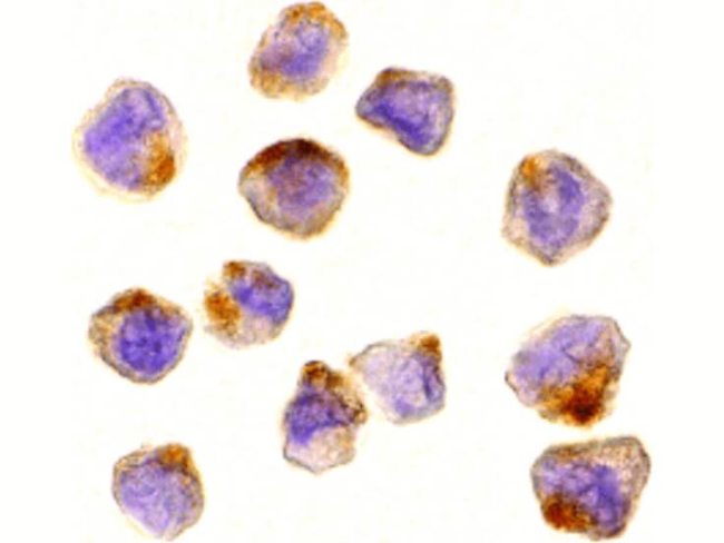 ASK1 Antibody in Immunocytochemistry (ICC/IF)