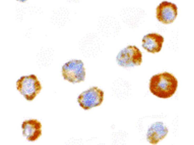 ASK1 Antibody in Immunocytochemistry (ICC/IF)