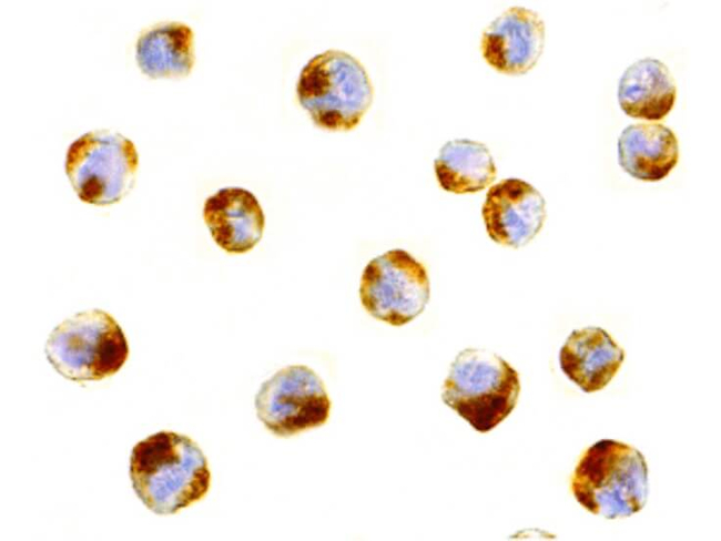 ATF6 Antibody in Immunocytochemistry (ICC/IF)