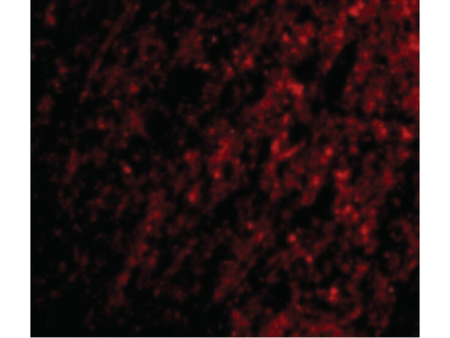 ATG12 Antibody in Immunocytochemistry (ICC/IF)