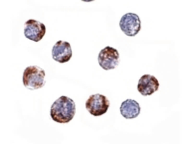 ATG16 Antibody in Immunocytochemistry (ICC/IF)
