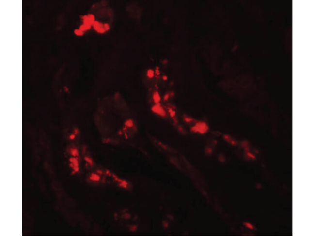 ATG3 Antibody in Immunocytochemistry (ICC/IF)