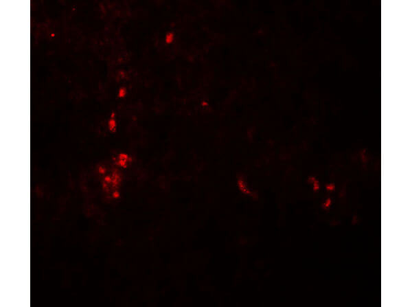 ATG4B Antibody in Immunocytochemistry (ICC/IF)