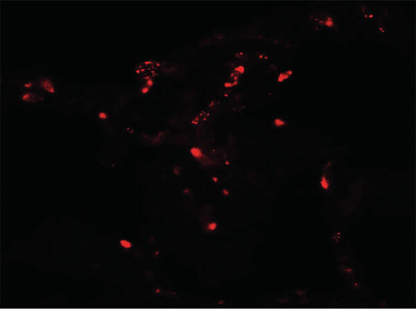 ATG4C Antibody in Immunocytochemistry (ICC/IF)
