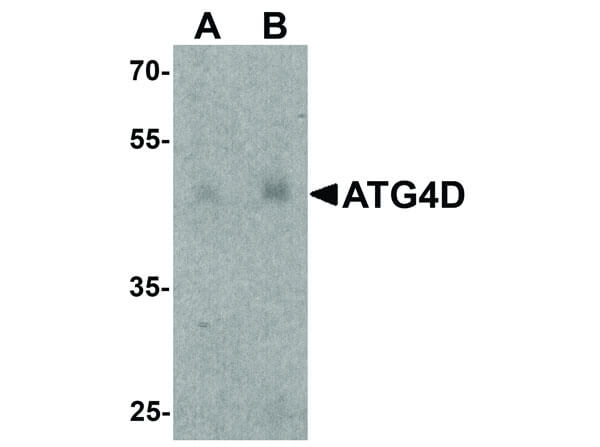 ATG4D Antibody in Western Blot (WB)