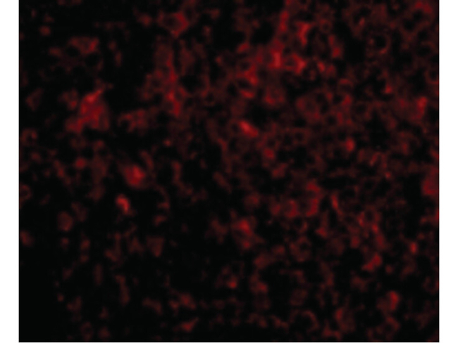 ATG5 Antibody in Immunocytochemistry (ICC/IF)