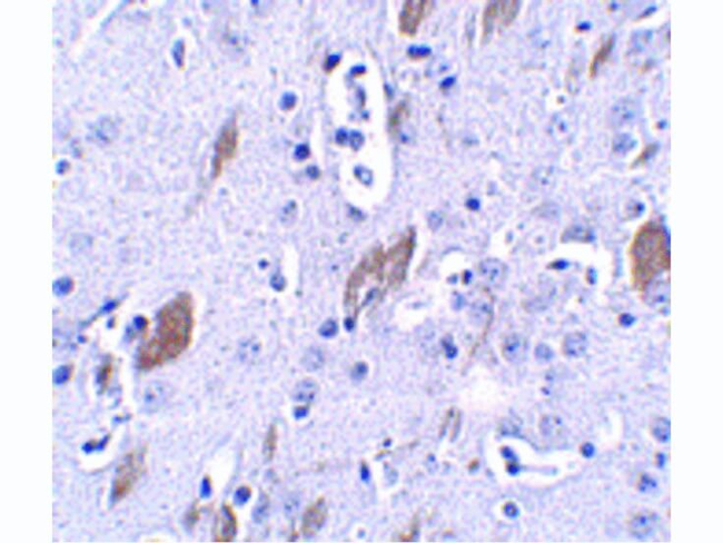 ATOH8 Antibody in Immunohistochemistry (Paraffin) (IHC (P))
