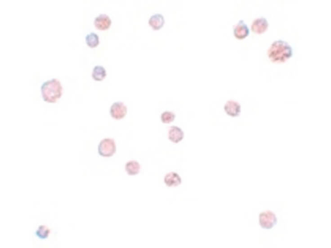 ATP11A Antibody in Immunocytochemistry (ICC/IF)