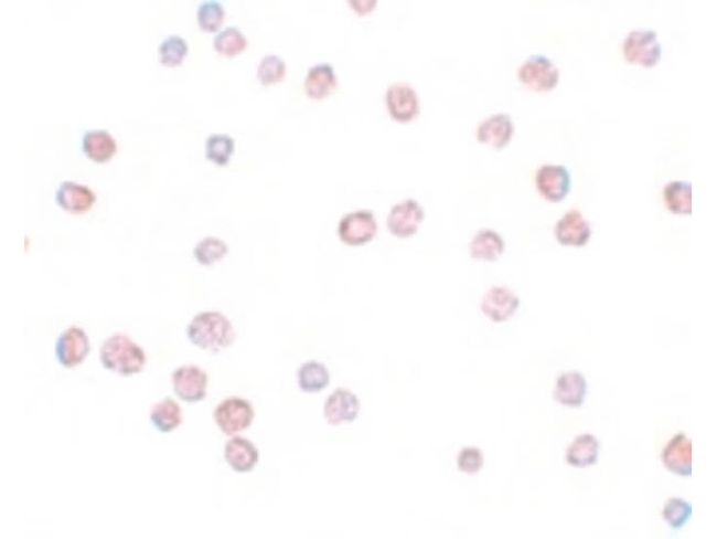 ATP11B Antibody in Immunocytochemistry (ICC/IF)