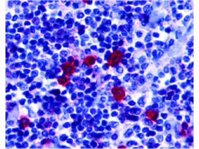 BAFF Receptor Antibody in Immunohistochemistry (Paraffin) (IHC (P))