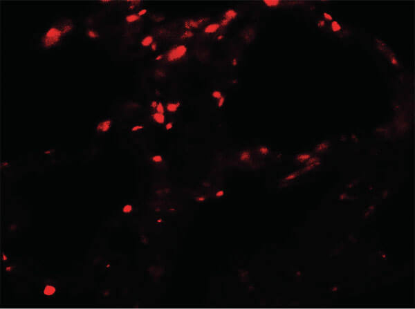 BAMBI Antibody in Immunocytochemistry (ICC/IF)