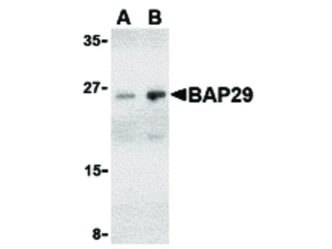 BAP29 Antibody in Western Blot (WB)