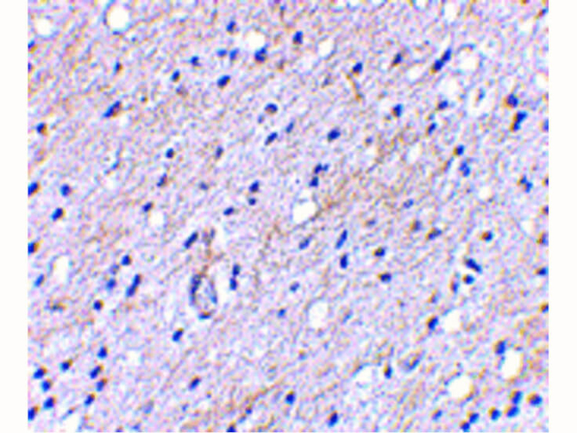 BAP3 Antibody in Immunohistochemistry (Paraffin) (IHC (P))