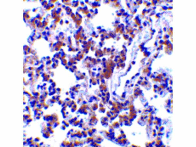 BAP31 Antibody in Immunohistochemistry (Paraffin) (IHC (P))