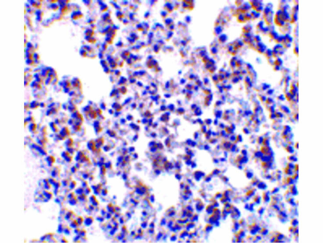 BAP31 Antibody in Immunohistochemistry (Paraffin) (IHC (P))