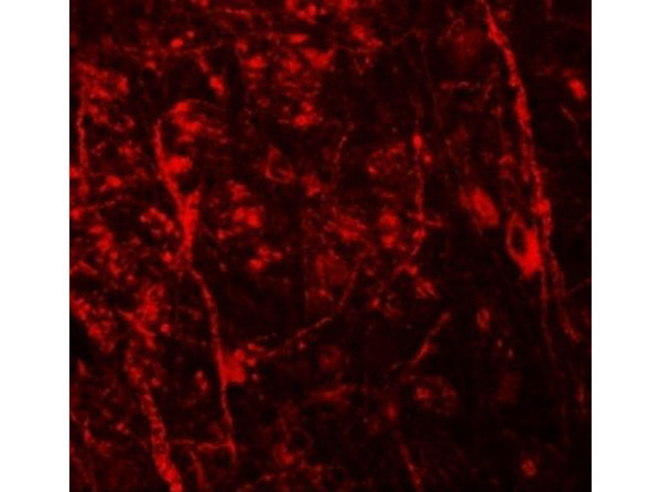 BAPX1 Antibody in Immunocytochemistry (ICC/IF)