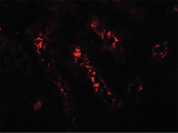 BATF3 Antibody in Immunocytochemistry (ICC/IF)