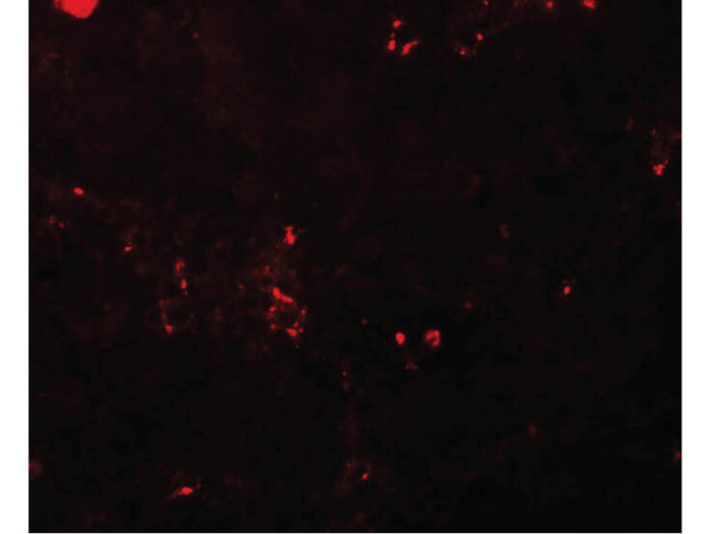 BCAS2 Antibody in Immunocytochemistry (ICC/IF)